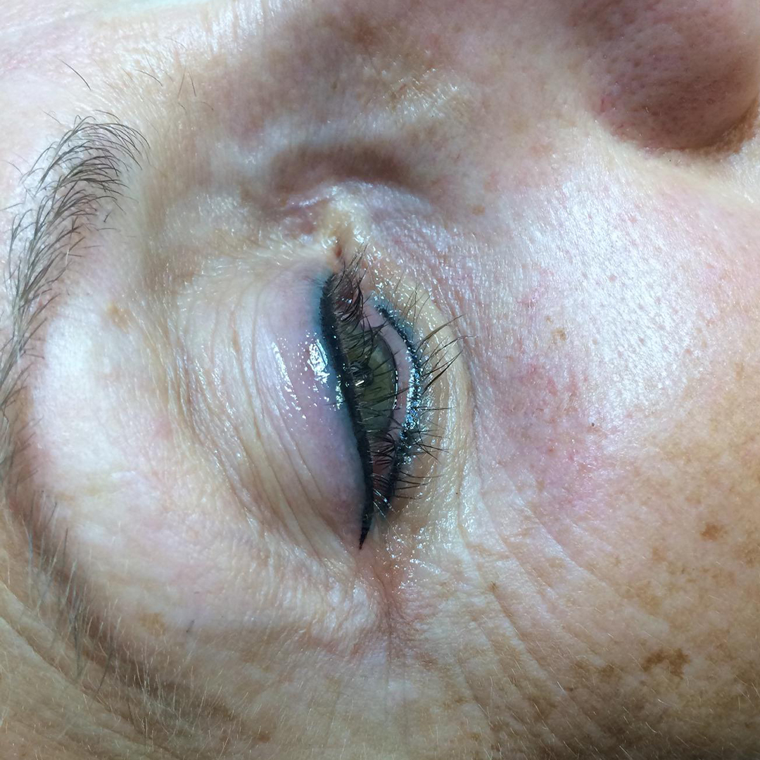 correction dermopigmentation yeux