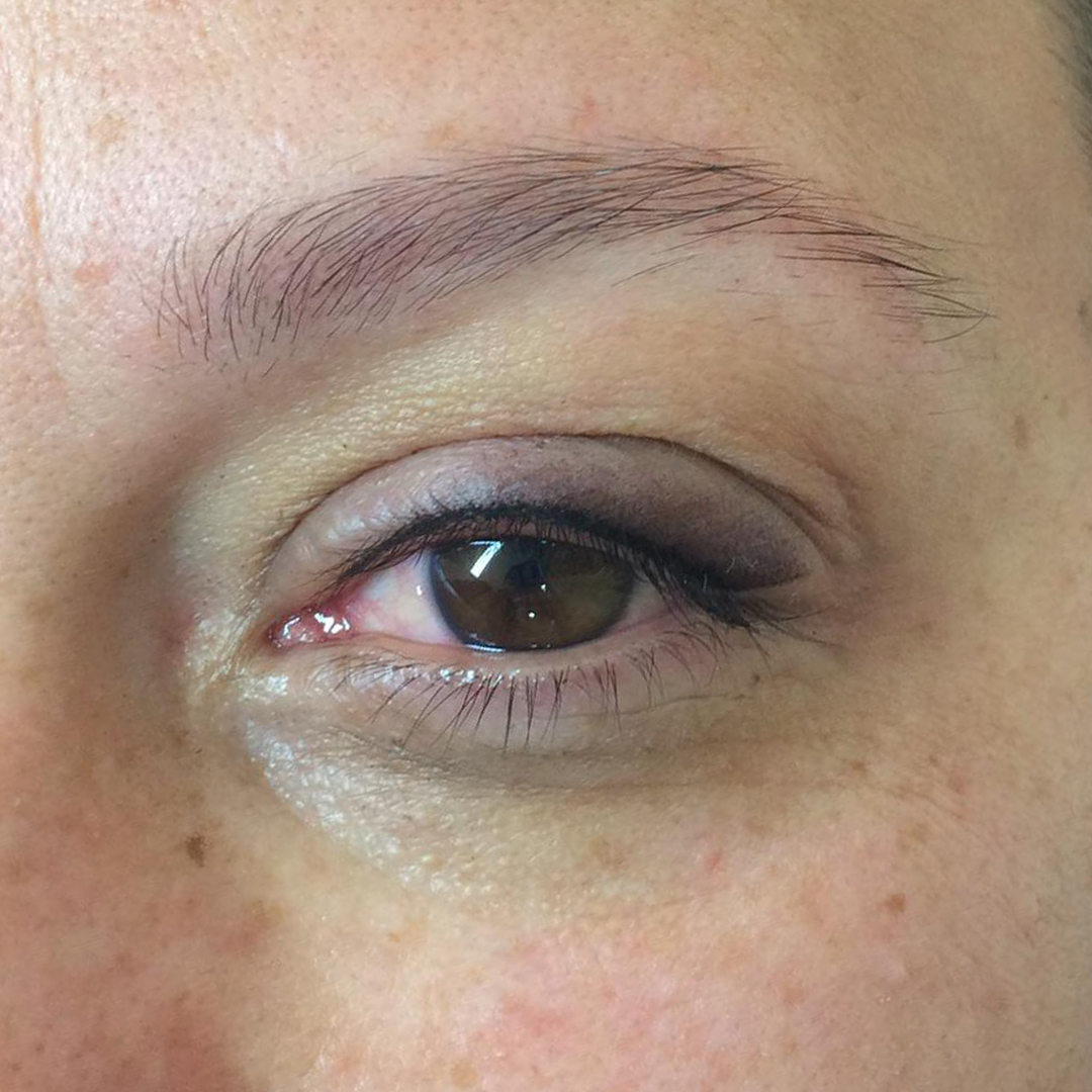 dermopigmentation yeux eye-liner degrade