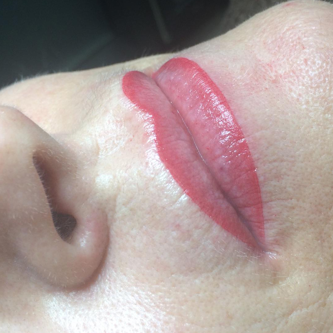 pigmentation levres contour degrade