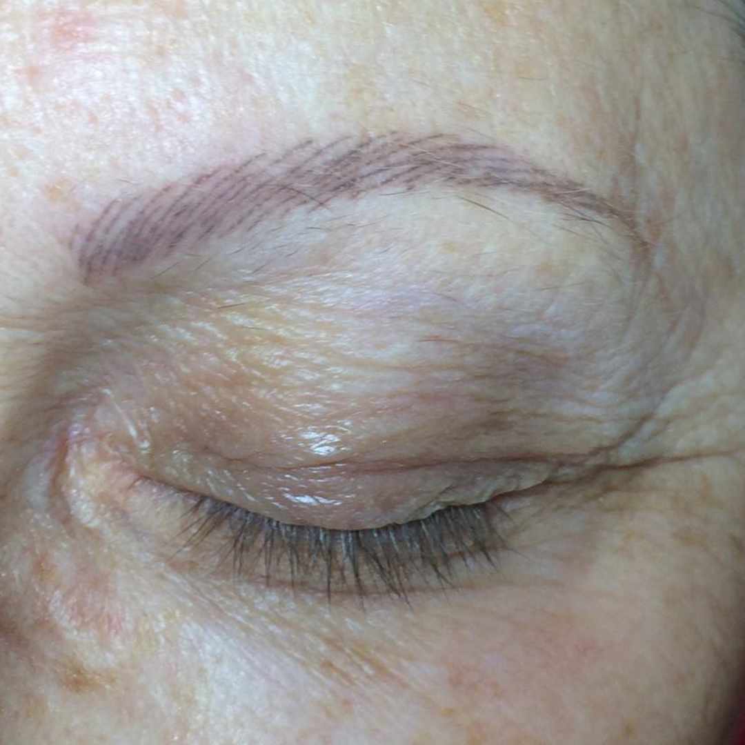 pigmentation sourcils peau mature